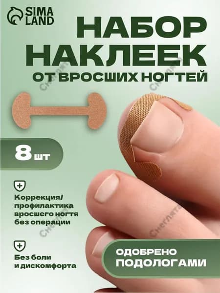 Набор наклеек от вросшего ногтя 8 шт
