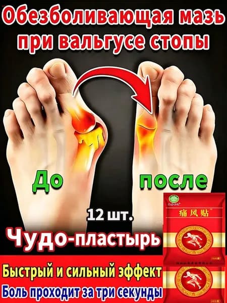 пластырь от косточки на большом пальце Облегчите боль в ногах и улучшите выпячивание суставов