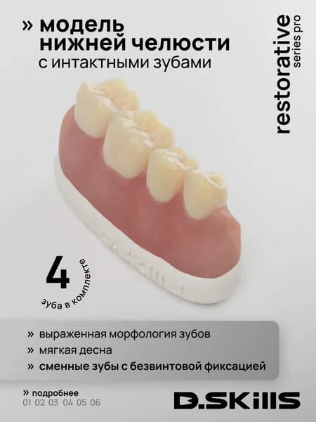Модель сегмента нижней челюсти с мягкой десной и сменными зубами