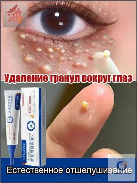 Крем для кожи вокруг глаз от белых точек и милиумов с точечным нанесением, 20 г