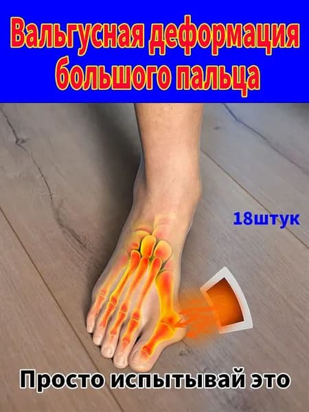 пластырь от косточки на большом пальце Облегчите боль в ногах и улучшите выпячивание суставов