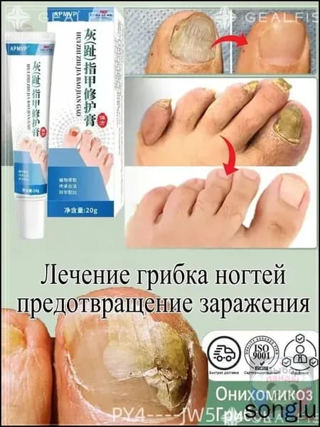 При грибке ногтей ног, 20 г, мазь Ноготок, восстанавливает и укрепляет Выбор панды