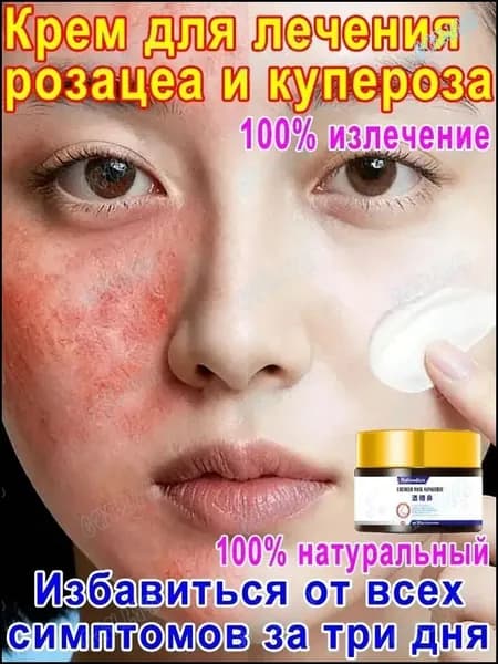 Эксклюзивный крем для чувствительной кожи, 30 г, от купероза JC-37Kremlin Luna Mist