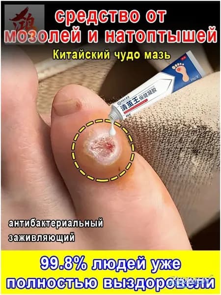 Мазь от мозолей, натоптышей и бородавок, 20 г, средство для удаления огрубевшей кожи