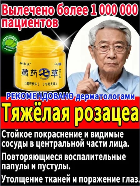 Мазь от Китайский розацеа на лице купероза и покраснений