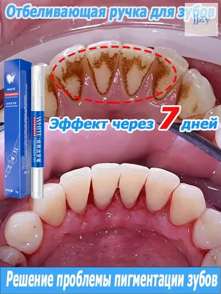 Профессиональная отбеливающая ручка для зубов, предназначена для очищения зубов от пигментации, удаления налета и зубного камня, 3 г