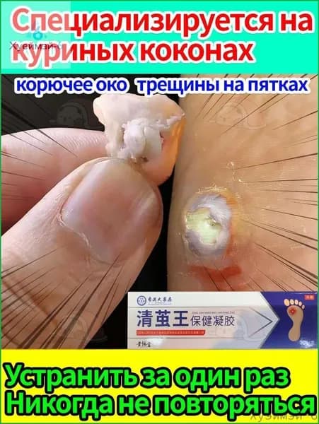 Средство от шипиц, натоптышей и сухих стержневых мозолей на ногах мазь и гель Корнекс 20 г