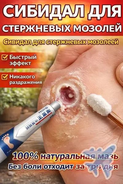 Средство от шипиц, натоптышей и сухих стержневых мозолей на ногах мазь и гель Корнекс,эффективное китайское средство