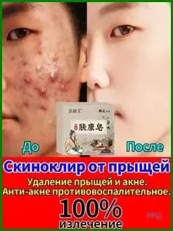 Аптечное мыло из Гонконга от прыщей и акне