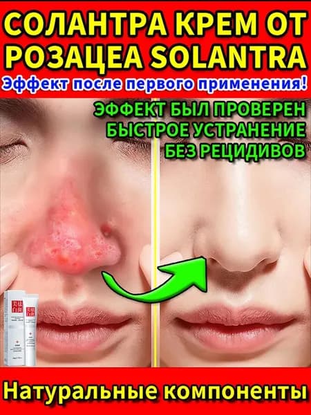 Крем-сыворотка для лица против прыщей, розацеа и купероза, негормональная, 20 г