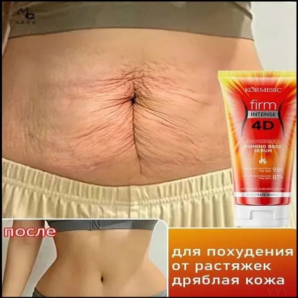 Эксклюзивный антицеллюлитный крем для моделирования тела, коррекции растяжек и упругости кожи