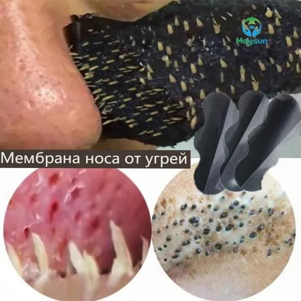 Очищает нос от прыщей, удаляет угри, уменьшает размер пор, глубокое очищение, нежные полоски для носа 20 шт.