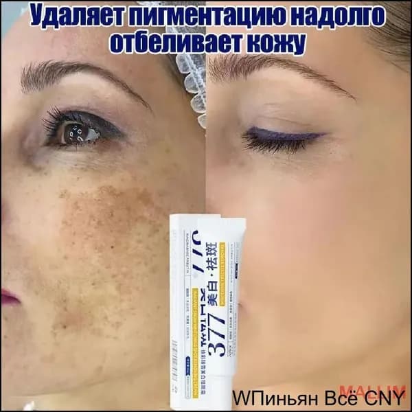 Осветляющий и увлажняющий премиумкрем с гиалуроновой кислотой, витаминами С и Е, используемый против пигментных пятен и веснушек, выпускается в объеме 30 г.