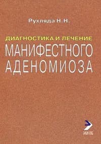 Диагностика и лечение манифестного аденомиоза | Рухляда Н. Н.