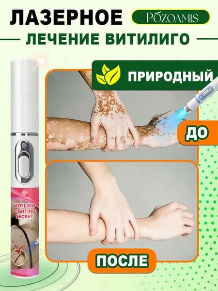 Лазерная ручка, разработанная специально для витилиго, точно осветляет белые пятна и выравнивает тон кожи. Без боли всего один стик поможет вернуть чистой, ровной и сияющей здоровой коже.