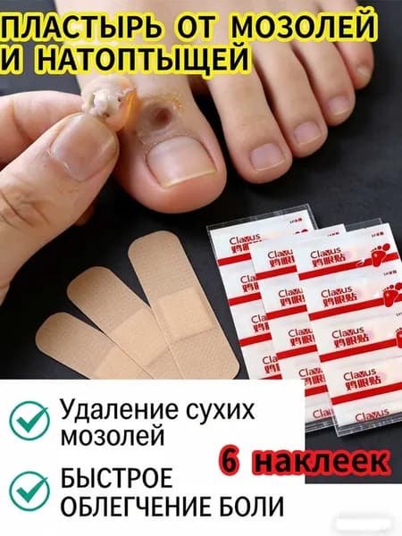 Пластырь для удаления сухих мозолей и натоптышей 6 шт, лечебный патч для стоп