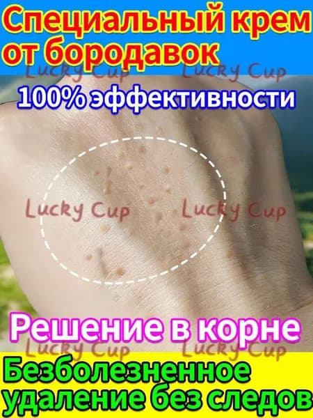 Безболезненное удаление плоских бородавок, папиллом, нитевидных и остроконечных кондилом без шрамов