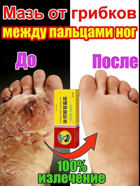 Эффективная серная мазь от грибка ног, лечение грибка стопы, от зуда и трещин