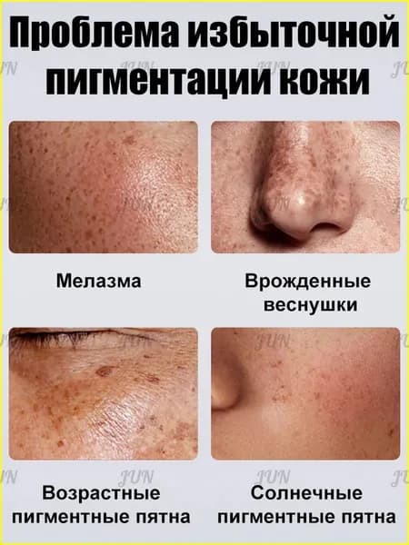 R tiderm антивозрастной крем для лица с гиалуроновой кислотой и 377, осветляет веснушки и пигментные пятна