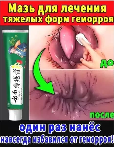 Китайская ЧУДО МАЗЬ от геморроя, 100% натуральная, не гормональная, крем от геморроя Чжи Чуан Гао 15 г