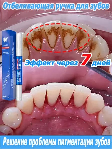 Профессиональная отбеливающая ручка для зубов, предназначена для очищения зубов от пигментации, удаления налета и зубного камня, 3 г