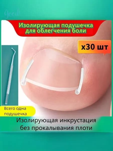 Корректор от вросшего ногтя1