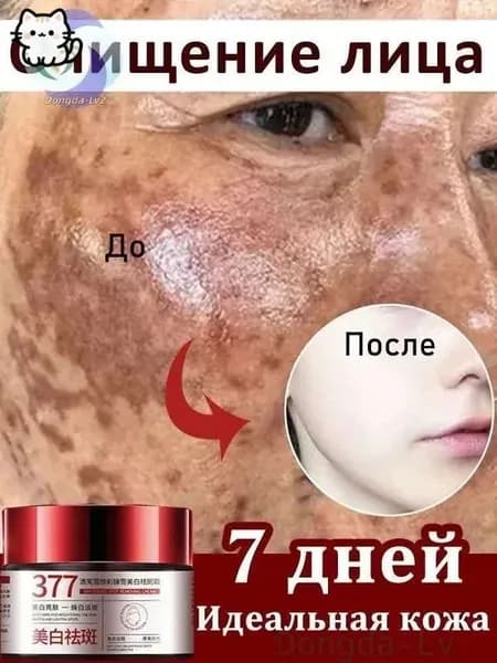 Крем для кожи: против веснушек и пигментных пятен, антипигментационный, отбеливающий, увлажняющий, 30 г, 1 шт