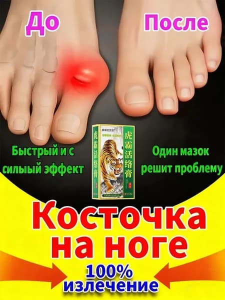 Крем при вальгусной деформации, от шишек на больших пальцах ног,пластырь обезболивающий для суставов и мышц,20 мл