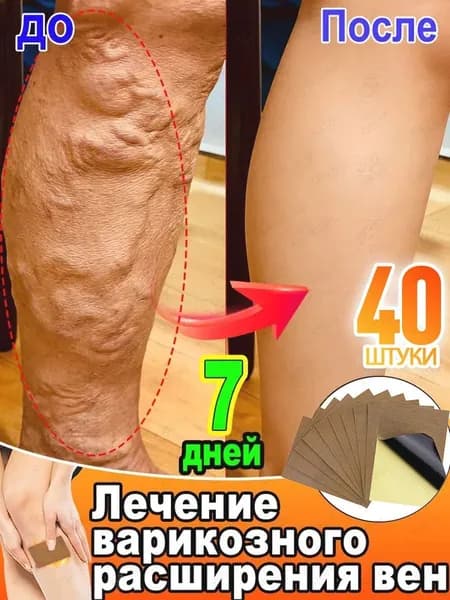 пластырь от варикоза на ногах,патчи от отеков,патчи для ногг,40 шт.