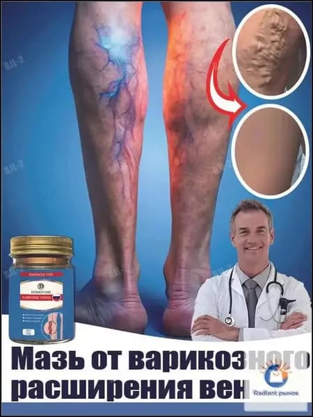 Эксклюзивное средство от варикоза, сосудистой сетки и тромбов, используемое для устранения отёчности и чувства тяжести в конечностях, 50 граммов.