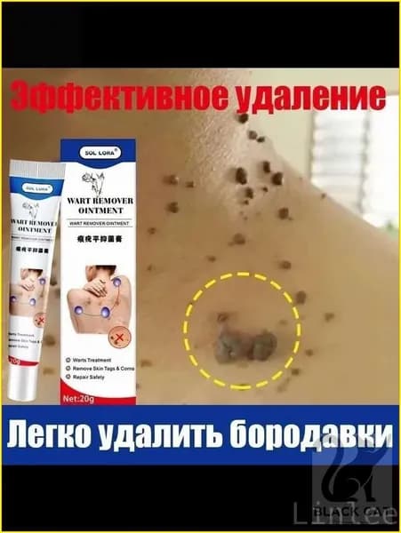 клареол гель средство от бородавок и папиллом, Для лечения бородавок, папиллом, мозолей на теле и лице Чистот
