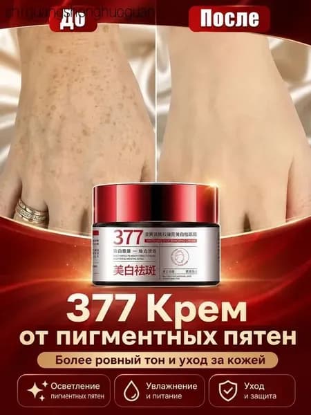 Крем от пигментации для лица, удаляет пигментные пятна, против пигментации, осветляет, для мужчин и женщин, 30 г