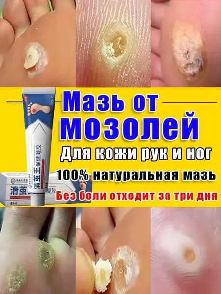 Пластырь от мозолей и натоптышей на ногах,Средство для пяток Чудо Пятки кератолитик против натоптышей, от мозолей и трещин.
