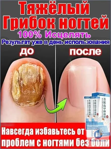 Регенератор Средство от онихолизиса и грибка ногтей