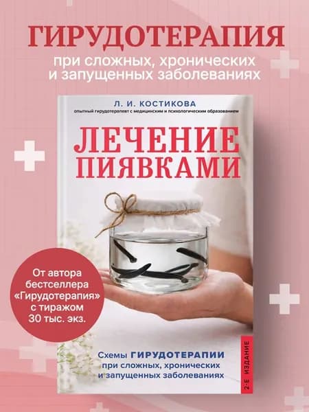 Лечение пиявками. Схемы гирудотерапии при сложных
