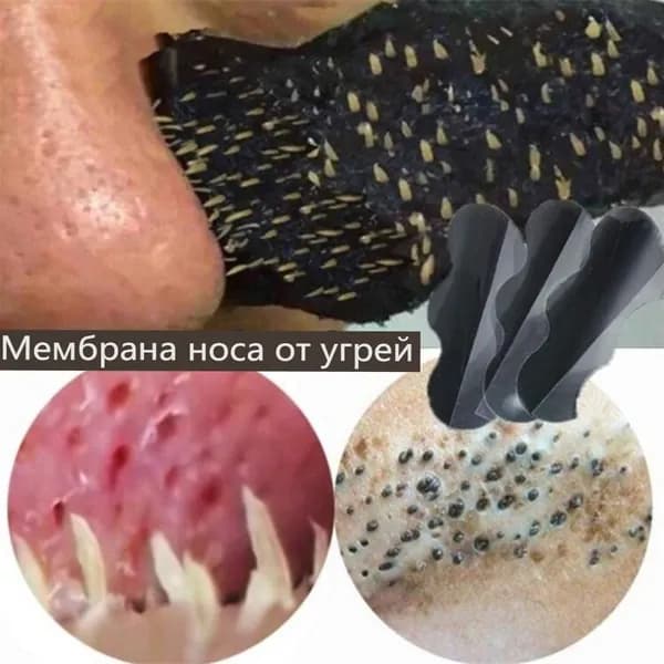 Очищает нос от прыщей, удаляет угри, уменьшает размер пор, глубокое очищение, нежные полоски для носа 10 шт.