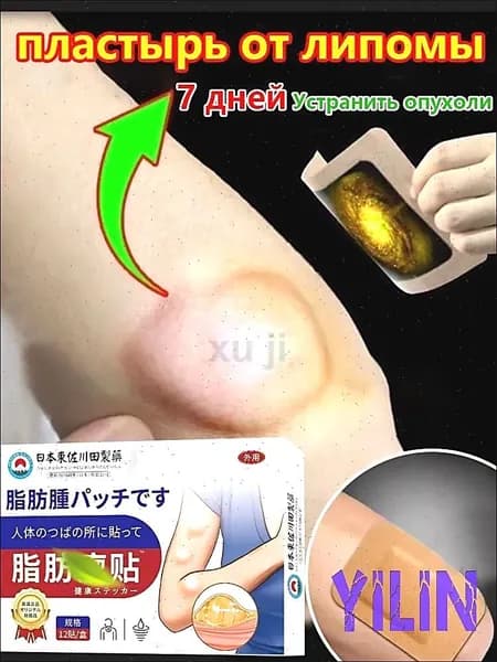 пластырь для удаления липомы 12 патчей для устранения кист сальной железы удаления подкожных опухолей и жировых комков