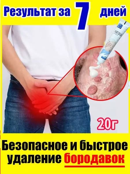 Крем для безболезненного устранения плоских и нитевидных бородавок, папиллом, остроконечных кондилом, родинок и подошвенных бородавок ,20г