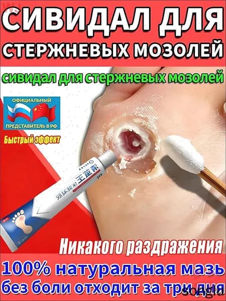 Средство от шипиц, натоптышей и сухих стержневых мозолей на ногах мазь и гель Корнекс,эффективное китайское средство