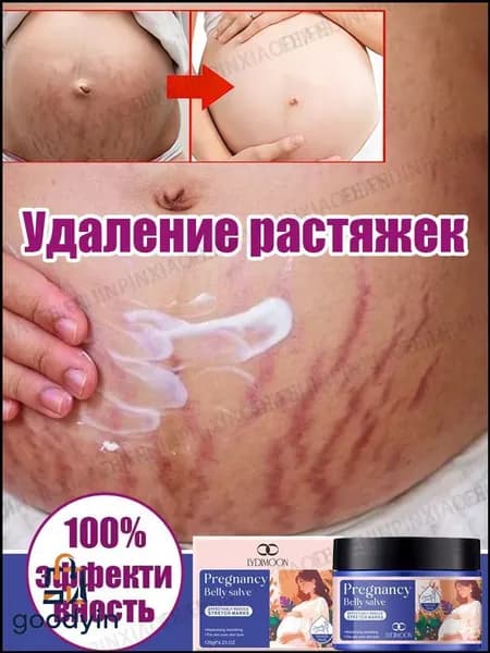 Крем от растяжек для беременных, Быстрое удаление растяжек, пигментации и шрамов,Послеродовые абдоминальные линии,восстанавливает эластичность кожи, подходит для ухода за кожей после родов 120 г.