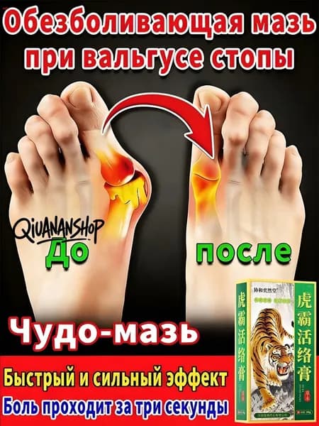 мазь от косточки на большом пальце, от шишек на больших пальцах ног