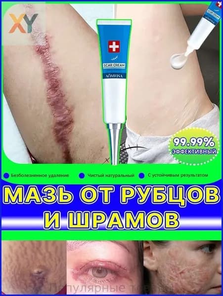 Гель от рубцов: для лечения растяжек, угревой сыпи, ожогов, послеоперационных и келоидных рубцов, 20 мл
