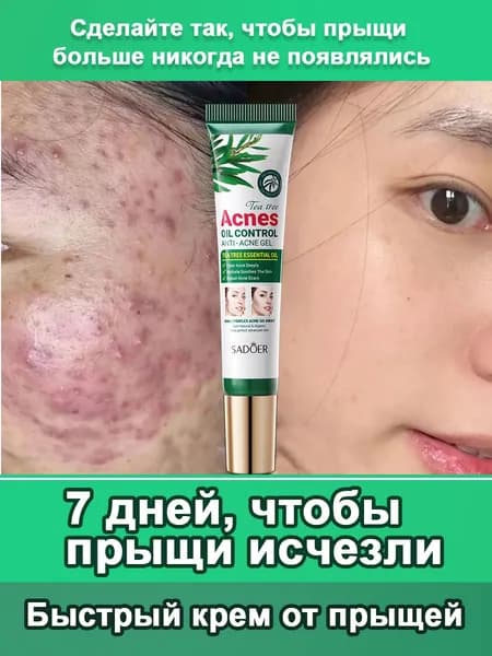 Крем от прыщей, устраняет угревую сыпь, предотвращает фолликулит, 20 г