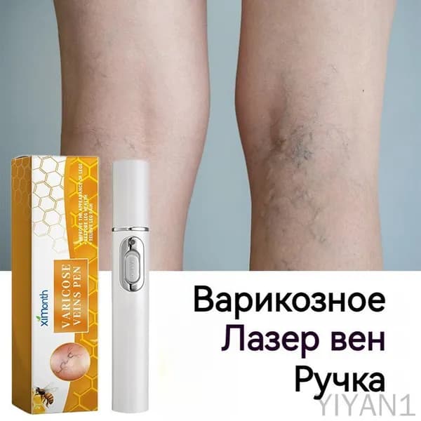 Ручка для лечения варикозного расширения вен,использовать для лечение сосудистых звездочек, тромбоза,отеков и тяжести в ногах,улучшает кровообращение