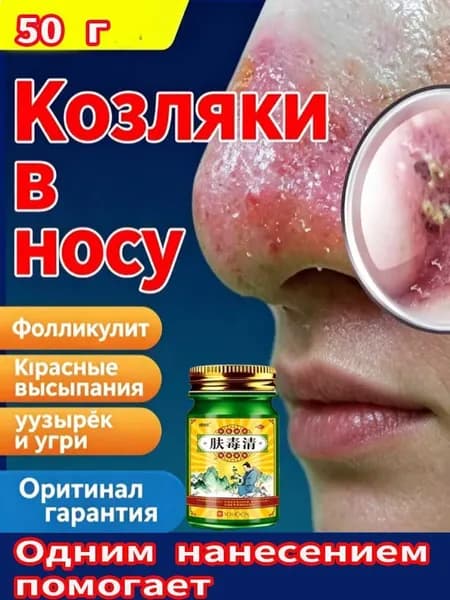 Эксклюзивная мазь от купероза, покраснений и розацеа наносится.