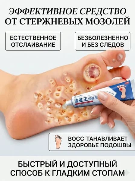 Мазь для удаления сухих мозолей, снятия огрубевшей кожи, лечения коконов и натоптышей на подошвах ног, 20 г