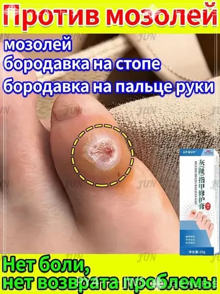 Пластырь и мазь для удаления стержневых мозолей и натоптышей на стопах и пальцах ног. Лечение сухих и болезненных мозолей. Эффективное средство