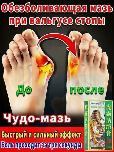 мазь от косточки на большом пальце, от шишек на больших пальцах ног