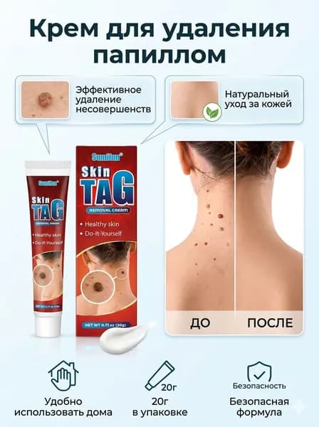 Крем против заболеваний кожи Sumifun Skin Tag 20 г,Крем для удаления папиллом и бородавок, средство от кожных новообразований на теле, для ухода за кожей лица и шеи, 20г