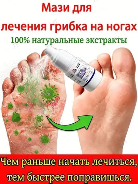 Спрей от запаха и пота ног противогрибковый 30мл, дезодорант для обуви, Спрей с антибактериальным действием для уменьшения потоотделения ног, устранения неприятного запаха